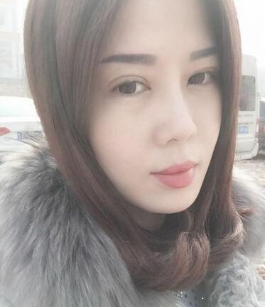 双眼皮恢复记录 果很满意~