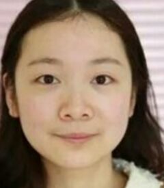 全切双眼皮让我眼睛变得更大更有神