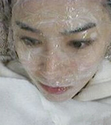 光子嫩肤 我的皮肤也可以白皙Q弹啦~