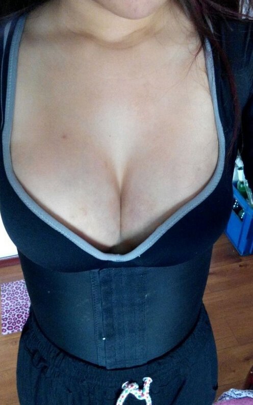 自体脂肪隆胸半个多月了 感觉很好！