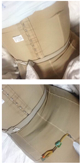 做了腰部吸脂 有图有真相！！！