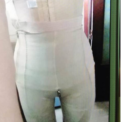 做了腰部吸脂 有图有真相！！！