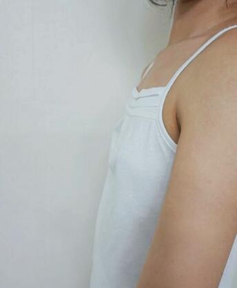 做了自体脂肪隆胸 魅力又回来了！