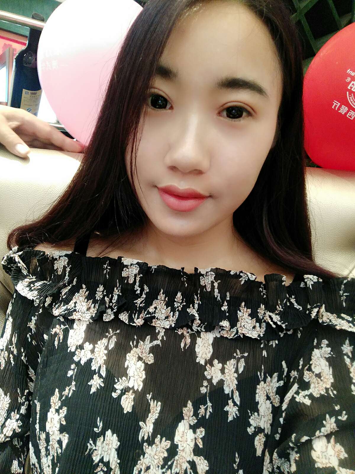 8.15号割的双眼皮 感谢慕医生