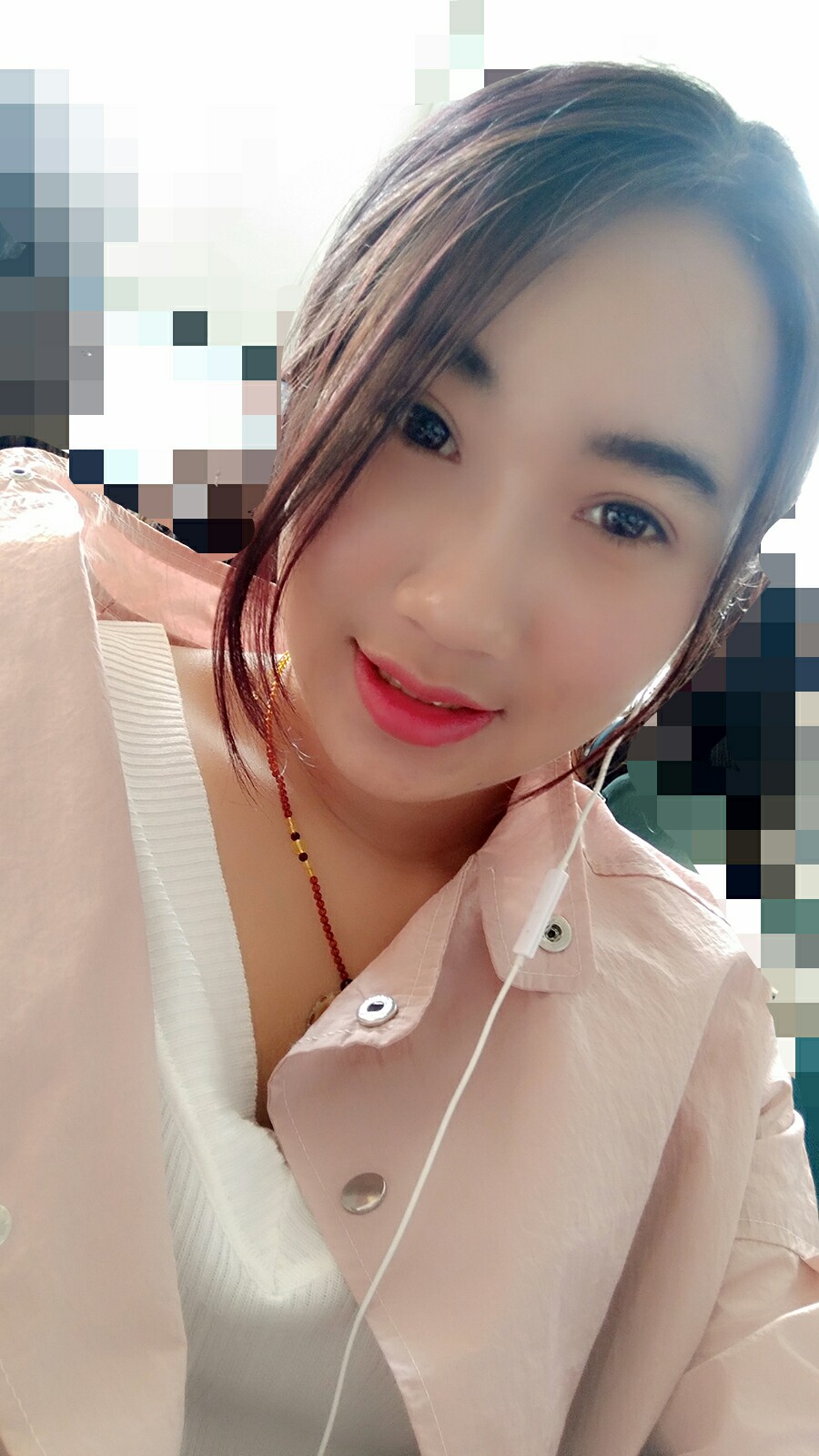 8.15号割的双眼皮 感谢慕医生