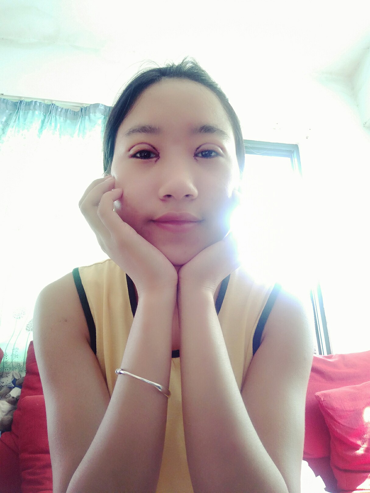 8.15号割的双眼皮 感谢慕医生