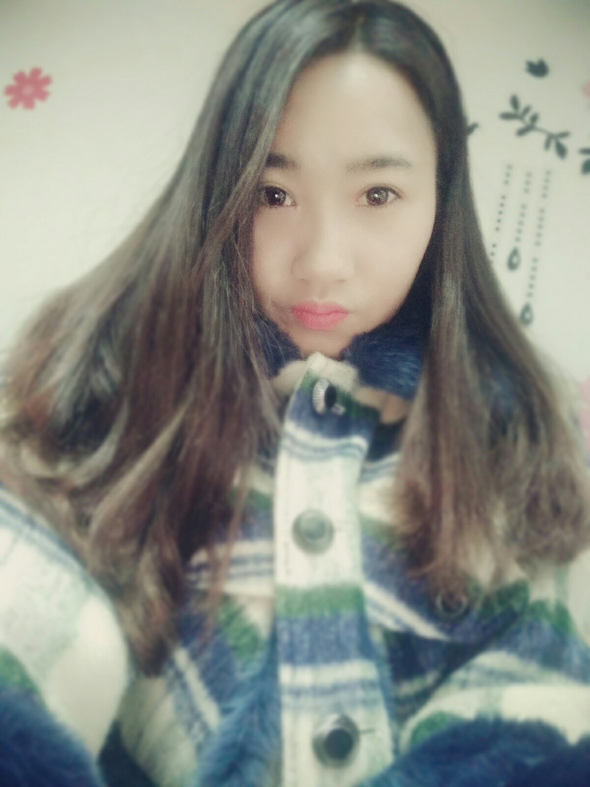 8.15号割的双眼皮 感谢慕医生