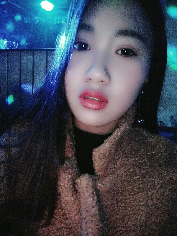 8.15号割的双眼皮 感谢慕医生