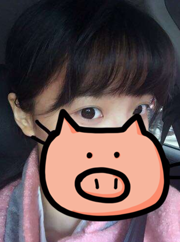 成都玉之光发际线种植 果不错~