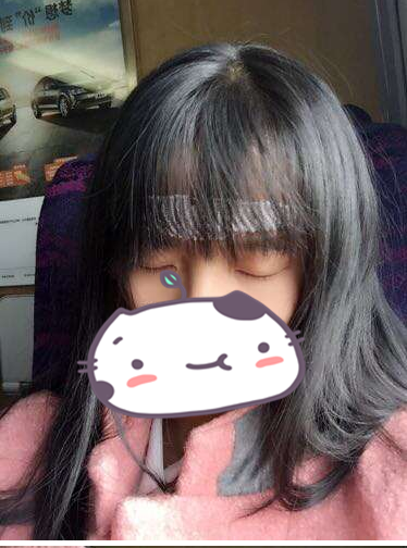 成都玉之光发际线种植 果不错~