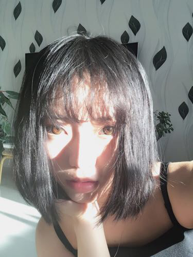 成都玉之光头发移植 果杠杠的~