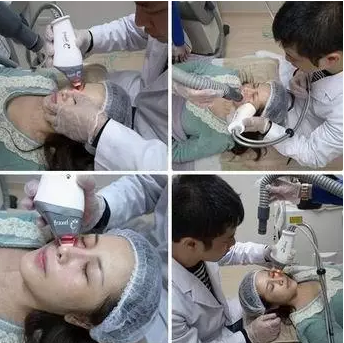 成都玉之光激光嫩肤经历 爱美的MM一定要看