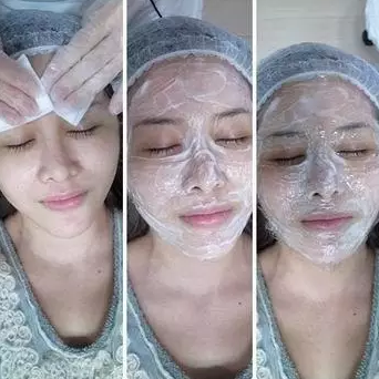 成都玉之光激光嫩肤经历 爱美的MM一定要看