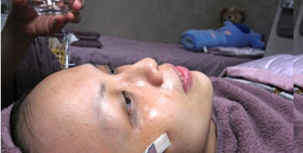 成都玉之光做了杏仁酸换肤 皮肤真的净白无瑕了