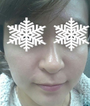 北京禾美嘉彩光嫩肤 果不错哦~