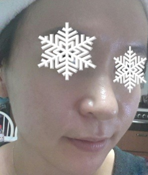 北京禾美嘉彩光嫩肤 果不错哦~