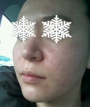 北京禾美嘉彩光嫩肤 果不错哦~