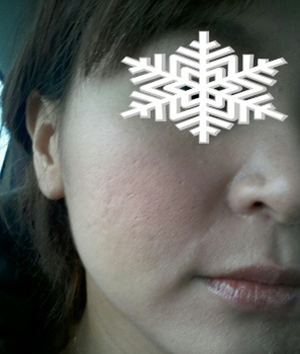 北京禾美嘉彩光嫩肤 果不错哦~