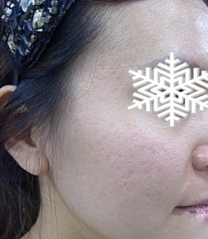 北京禾美嘉彩光嫩肤 果不错哦~