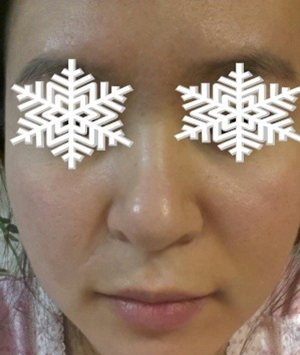 北京禾美嘉彩光嫩肤 果不错哦~