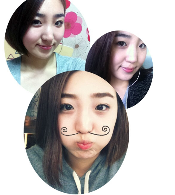 深圳希思崔院长隆鼻整形 摆脱了猪妹妹的称号