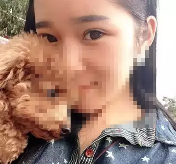 深圳希思做的双眼皮 现在美美的