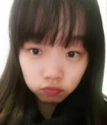 全切双眼皮+去脂肪，终于摆脱小眼睛了