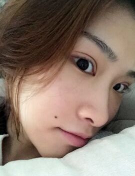 硅胶隆鼻还垫鼻尖了，甘泉涌做的果真的很好哟
