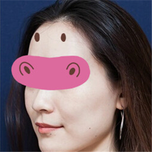 新疆,整形,美容,医院,音波,拉皮