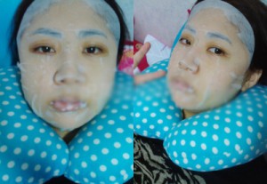 在北京炫美磨了下颌角 恢复纪实分享