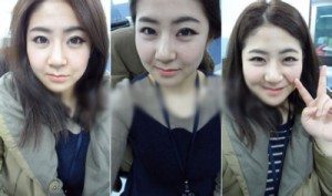 在北京炫美磨了下颌角 恢复纪实分享