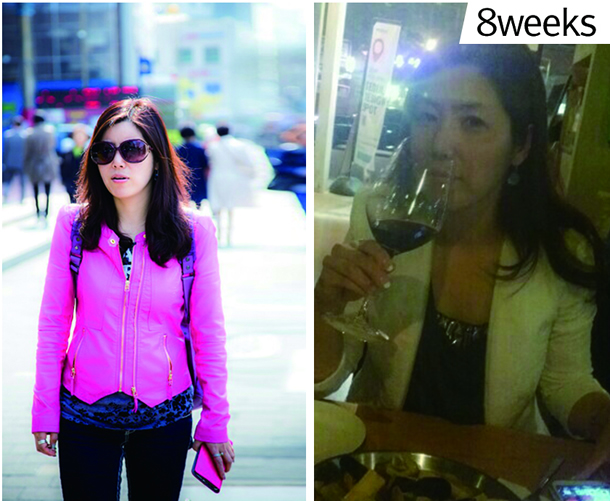 电波l皮除皱让我弹走小皱纹 果真的很不错