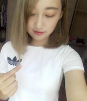 隆鼻整形给我带来无比**的鼻子