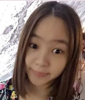 罗定安医生做的隆鼻整形鼻子特别秀丽