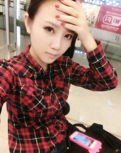 假体隆鼻15天后恢复果 杭州时光做的~