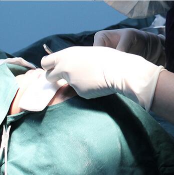 双眼皮手术让我单眼皮变双眼皮就是这么简单