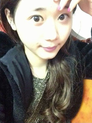 北京常好丽格割双眼皮一周啦~