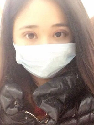 北京常好丽格割双眼皮一周啦~