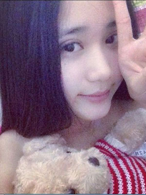 北京常好丽格割双眼皮一周啦~