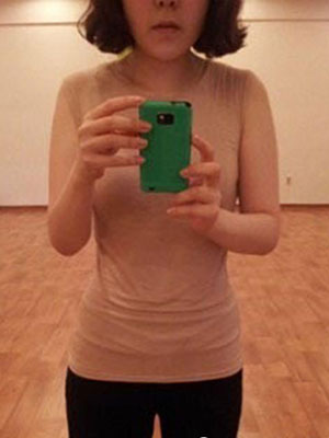 北京常好丽格腰腹吸脂后20天的感受 恢复日记来咯~