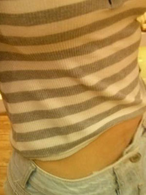 北京常好丽格腰腹吸脂后20天的感受 恢复日记来咯~