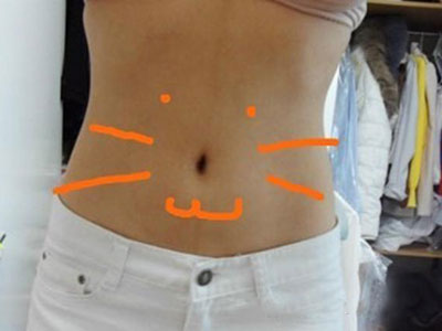 北京常好丽格腰腹吸脂后20天的感受 恢复日记来咯~