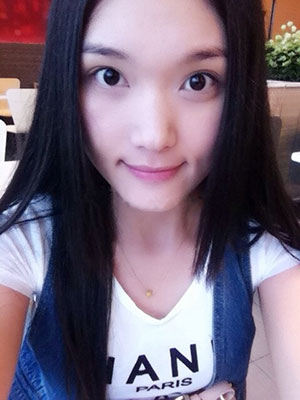 北京常好丽格做假体隆鼻3个月