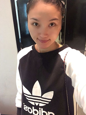 北京常好丽格做假体隆鼻3个月