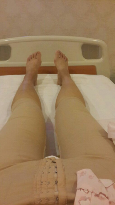 水动力吸脂瘦大腿让我夏天放肆嗨