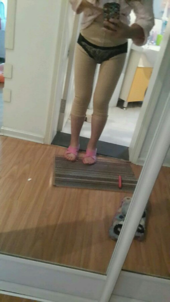 水动力吸脂瘦大腿让我夏天放肆嗨