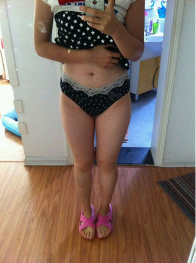 水动力吸脂瘦大腿让我夏天放肆嗨