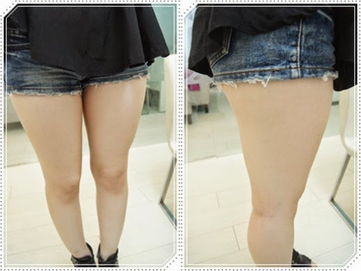 自体脂肪丰胸让我的小平胸变成大豪乳