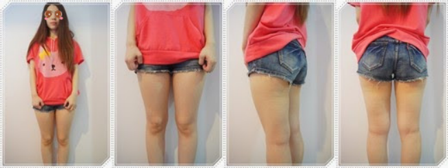 自体脂肪丰胸让我的小平胸变成大豪乳