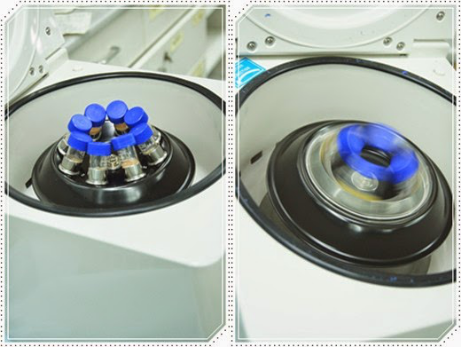 自体脂肪丰胸让我的小平胸变成大豪乳